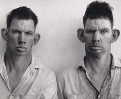 Image result for inbred twins