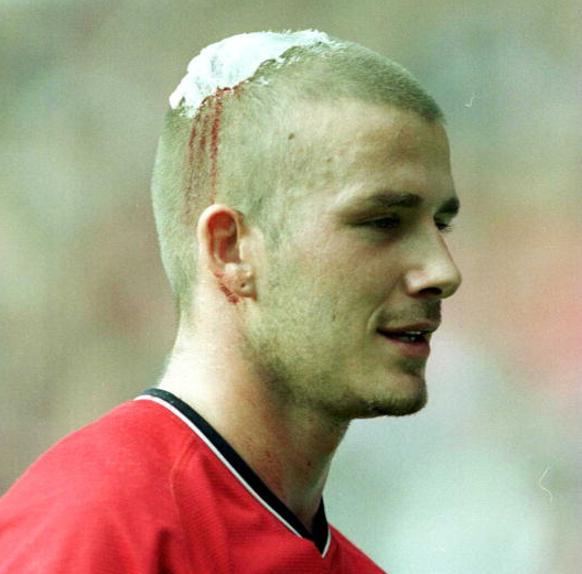 Sir Alex Ferguson Once Forced David Beckham To Shave His